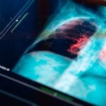 Hazine iki tahville 79,2 milyar TL borçlandı