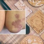 Demansla boğuşan ünlü oyuncu hayata veda etti